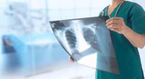 doctor radiologist looking lung x-ray film of patient at hospital