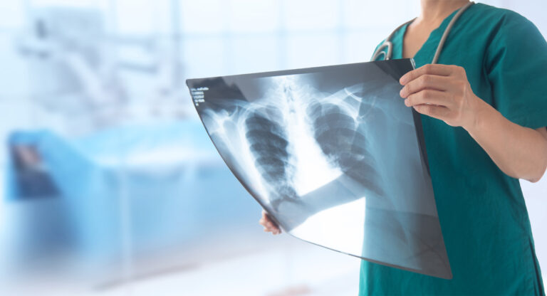 doctor radiologist looking lung x-ray film of patient at hospital