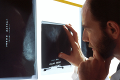 Mammography: Image Evaluation and Interpretation Principles