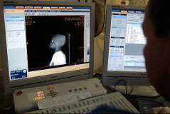 CT Image Evaluation