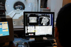 CT Procedures: Chest and Abdomen